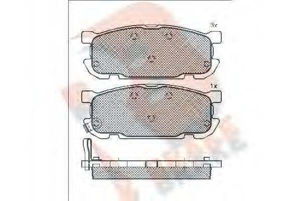 R BRAKE RB1541